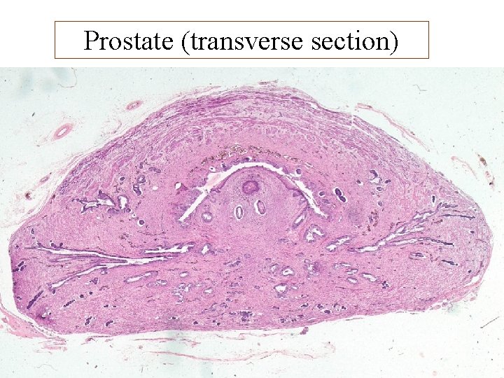 Prostate (transverse section) 