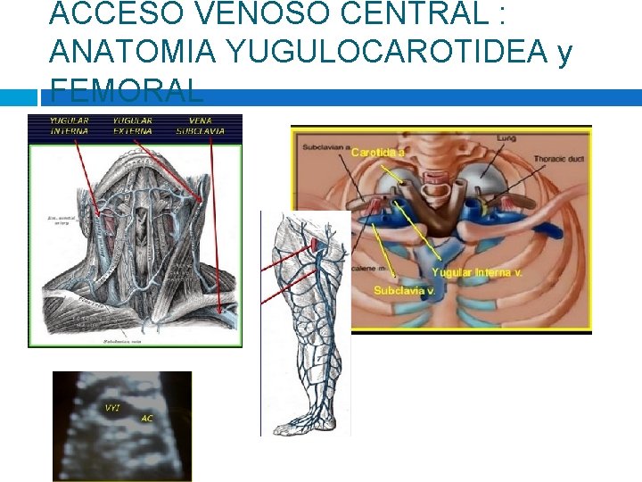 ACCESO VENOSO CENTRAL : ANATOMIA YUGULOCAROTIDEA y FEMORAL 