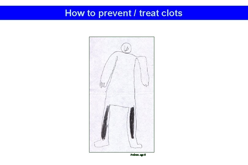 How to prevent / treat clots Andrew, age 8 