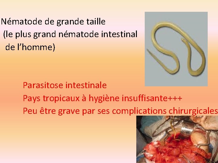 Nématode de grande taille (le plus grand nématode intestinal de l’homme) Parasitose intestinale Pays