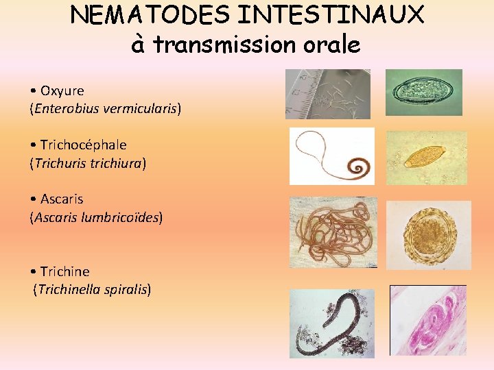 NEMATODES INTESTINAUX à transmission orale • Oxyure (Enterobius vermicularis) • Trichocéphale (Trichuris trichiura) •