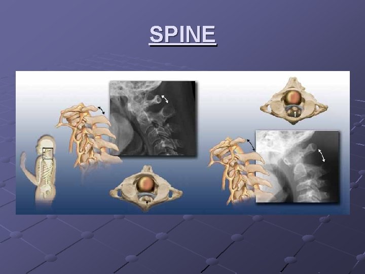 SPINE 