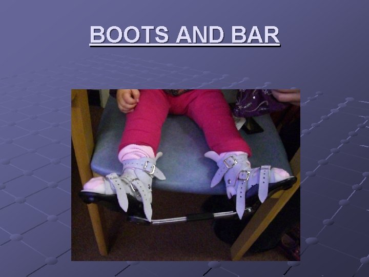 BOOTS AND BAR 