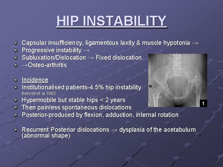 HIP INSTABILITY Capsular insufficiency, ligamentous laxity & muscle hypotonia → Progressive instability → Subluxation/Dislocation