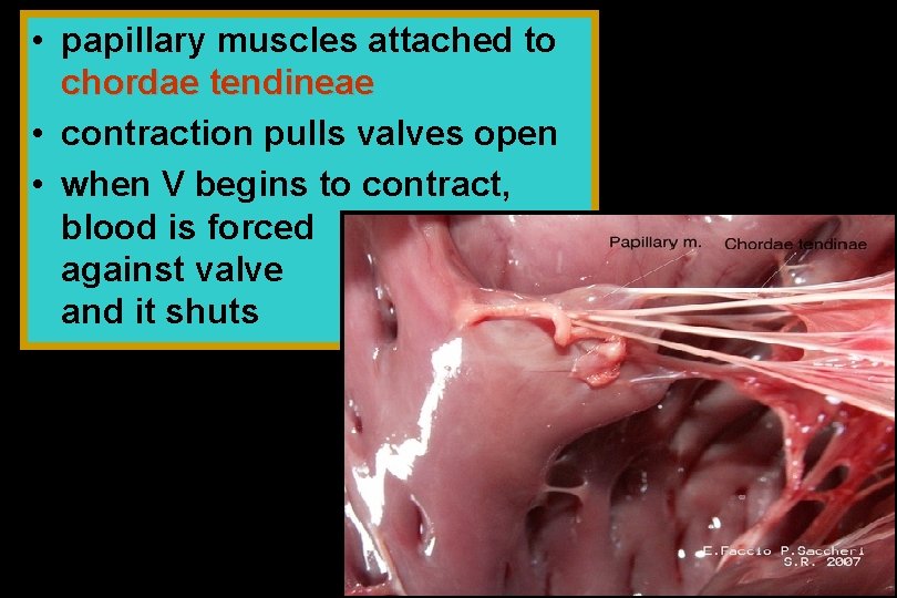  • papillary muscles attached to chordae tendineae • contraction pulls valves open •