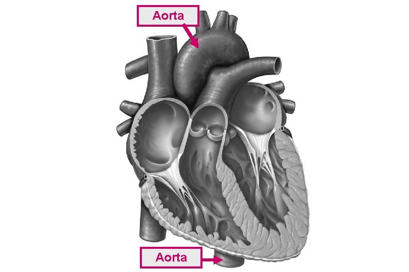 Aorta 