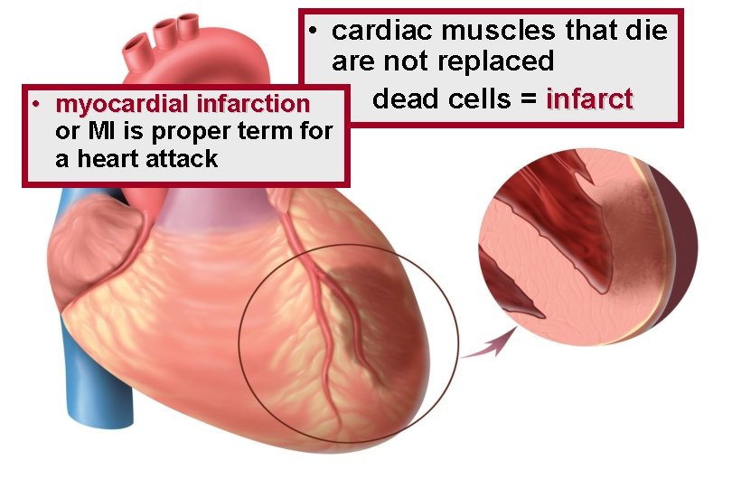  • cardiac muscles that die are not replaced dead cells = infarct •