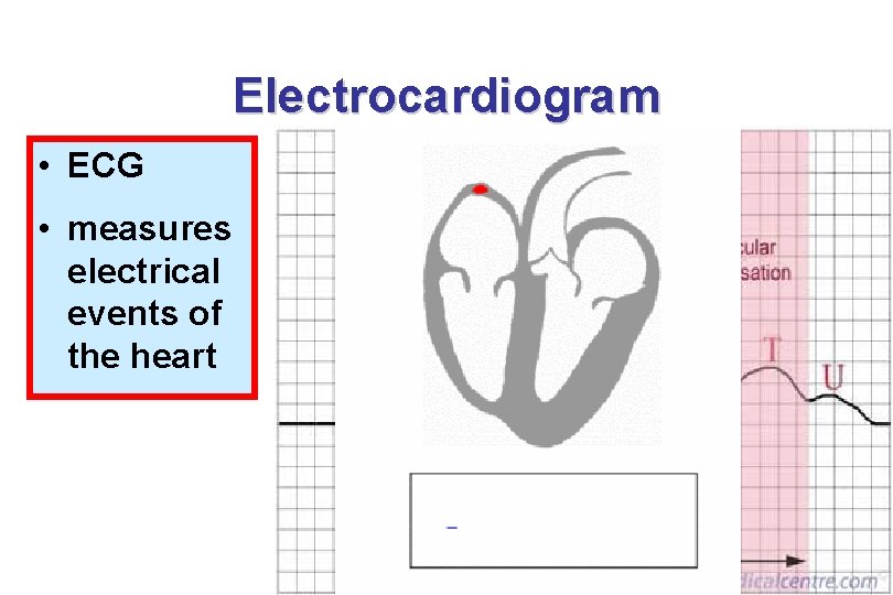 Electrocardiogram • ECG • measures electrical events of the heart 