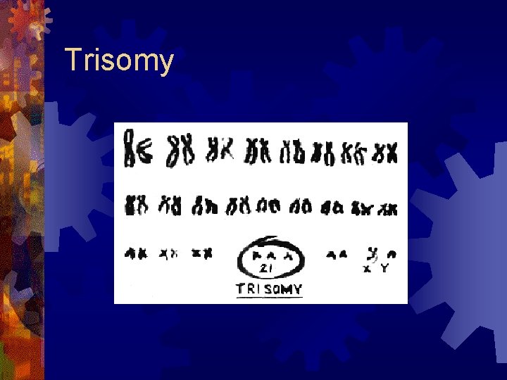 Trisomy 
