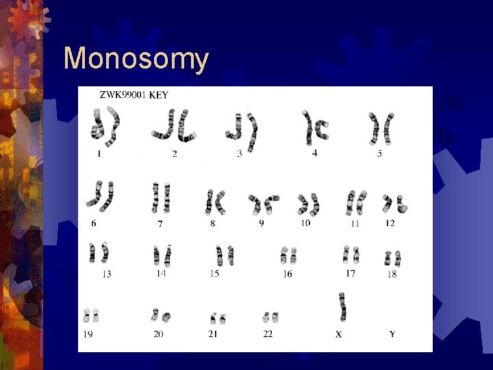 Monosomy 