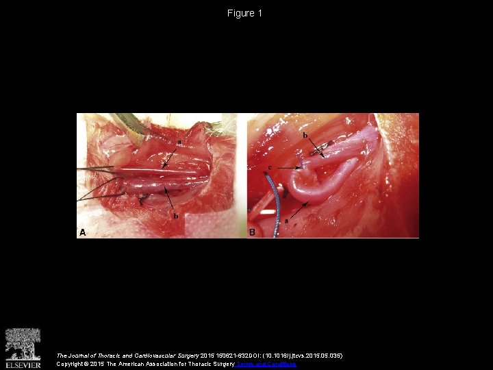 Figure 1 The Journal of Thoracic and Cardiovascular Surgery 2015 150621 -632 DOI: (10.