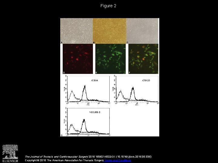 Figure 2 The Journal of Thoracic and Cardiovascular Surgery 2015 150621 -632 DOI: (10.