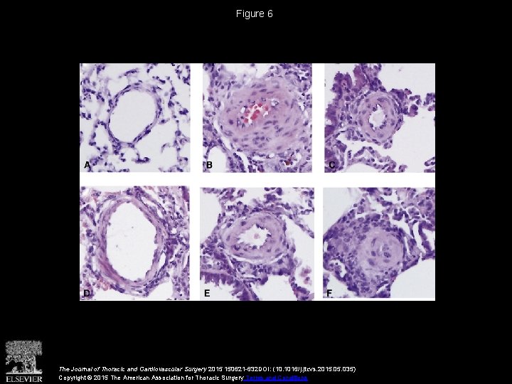 Figure 6 The Journal of Thoracic and Cardiovascular Surgery 2015 150621 -632 DOI: (10.