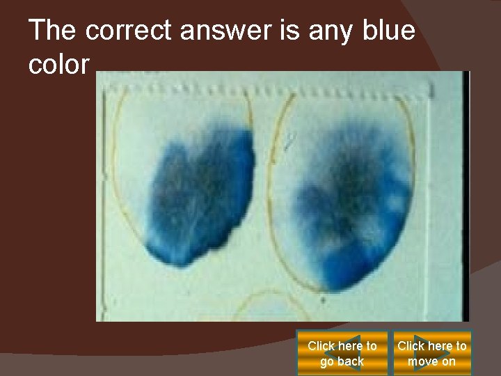 The correct answer is any blue color Click here to go back Click here