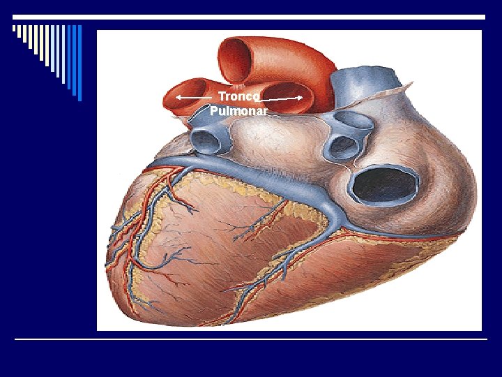 Tronco Pulmonar 