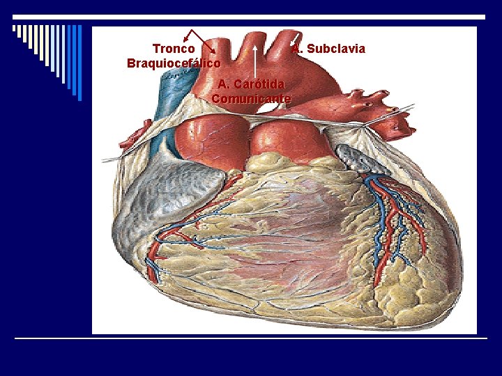 Tronco Braquiocefálico A. Subclavia A. Carótida Comunicante 