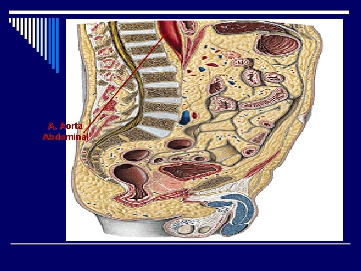 A. Aorta Abdominal 