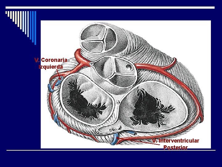 V. Coronaria Izquierda V. Interventricular Posterior 