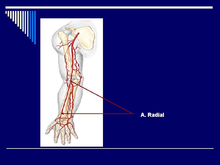 A. Radial 