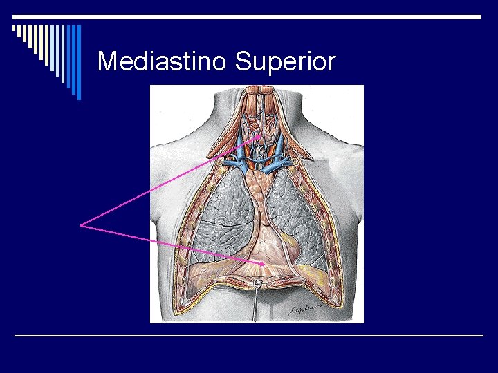 Mediastino Superior 