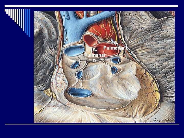 A. Pulmonar I. A. Pulmonar D. 