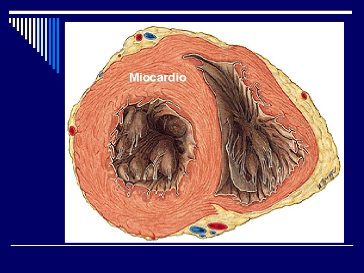 Miocardio 