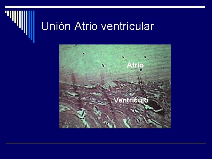 Unión Atrio ventricular Atrio Ventrículo 