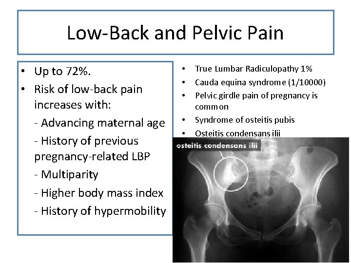 Low-Back and Pelvic Pain • Up to 72%. • Risk of low-back pain increases