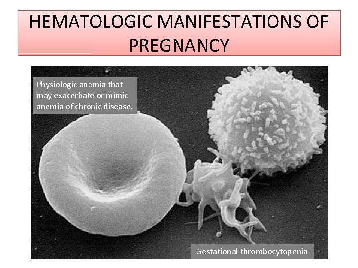 HEMATOLOGIC MANIFESTATIONS OF PREGNANCY Physiologic anemia that may exacerbate or mimic anemia of chronic