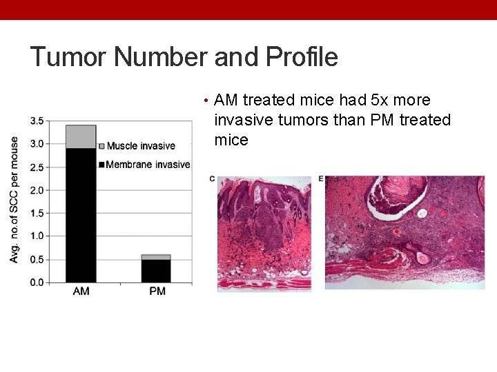 Tumor Number and Profile • AM treated mice had 5 x more invasive tumors
