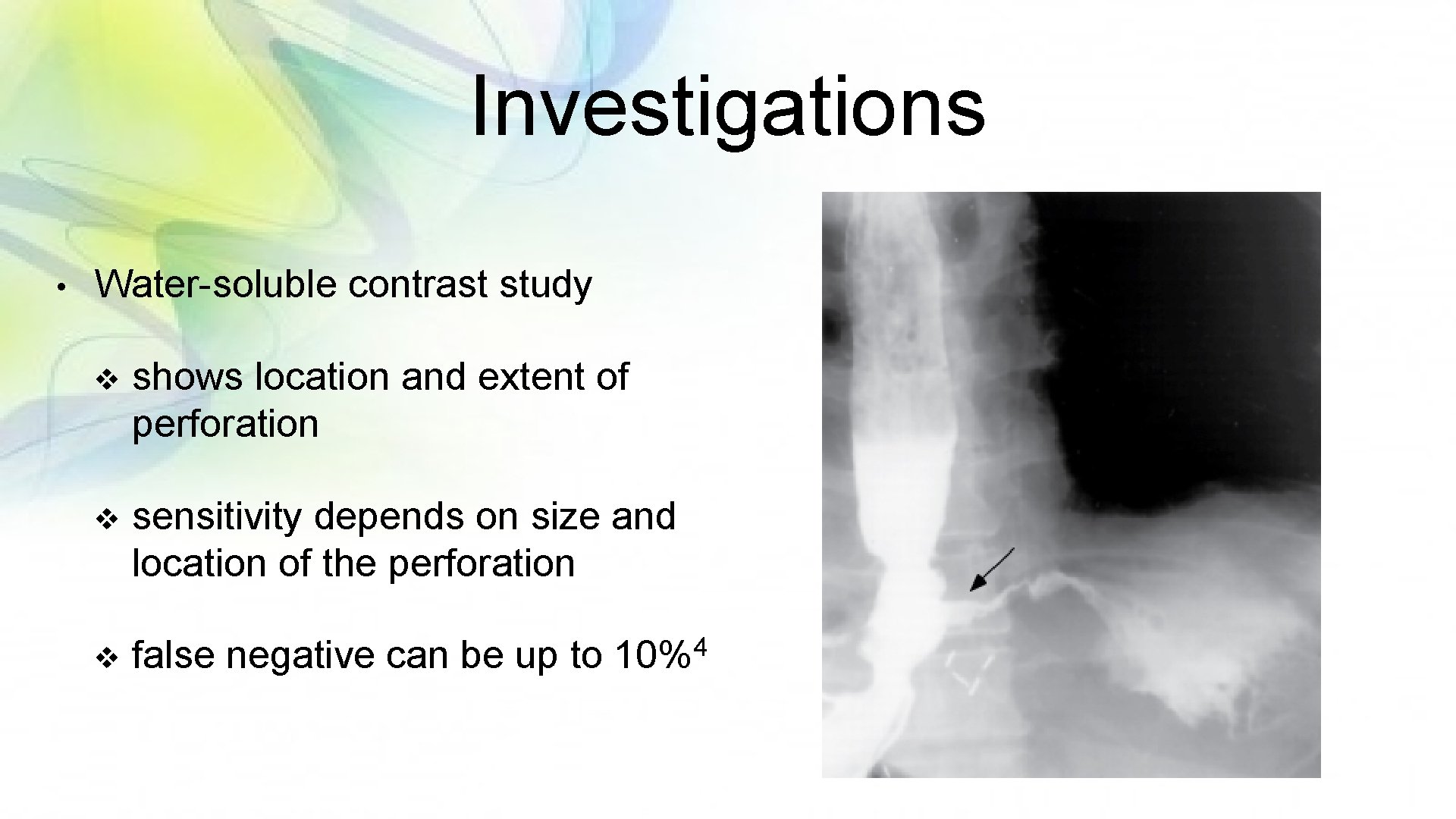Investigations • Water-soluble contrast study v shows location and extent of perforation v sensitivity