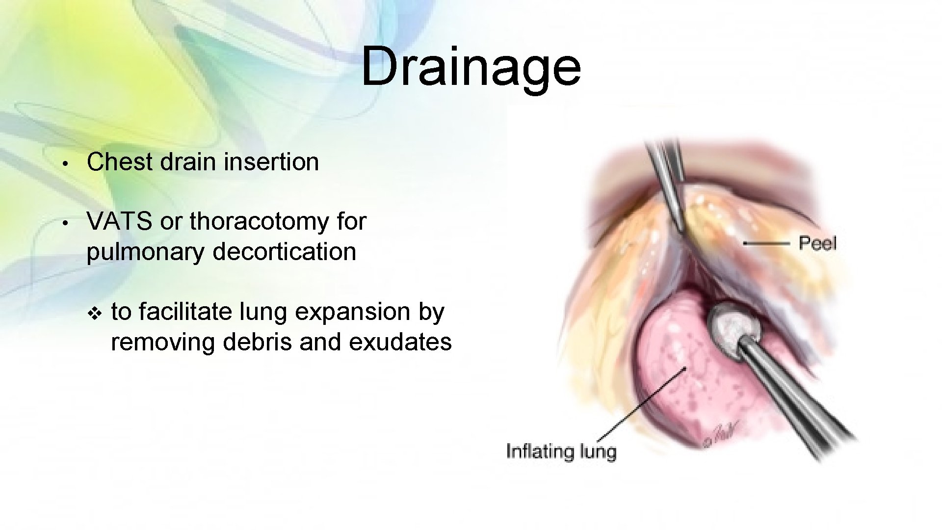 Drainage • Chest drain insertion • VATS or thoracotomy for pulmonary decortication v to