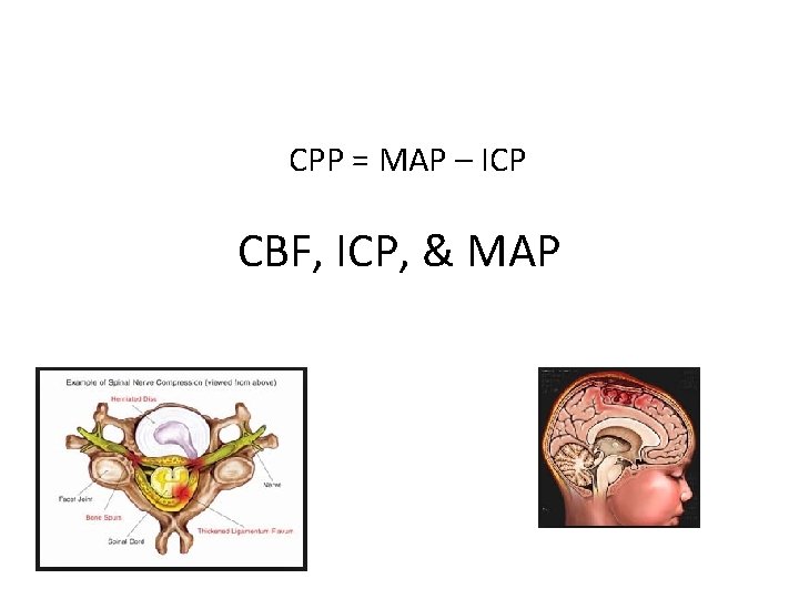 CPP = MAP – ICP CBF, ICP, & MAP 