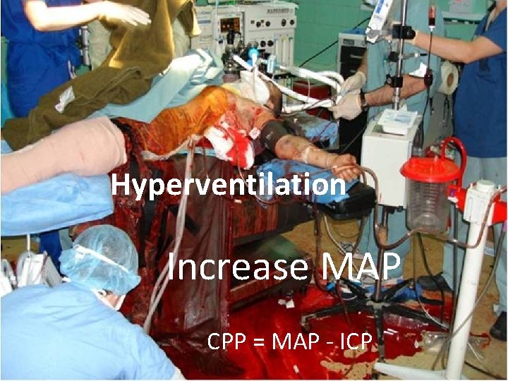 Hyperventilation Increase MAP CPP = MAP - ICP 