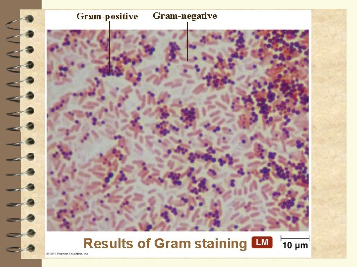 Gram-positive Gram-negative Results of Gram staining 