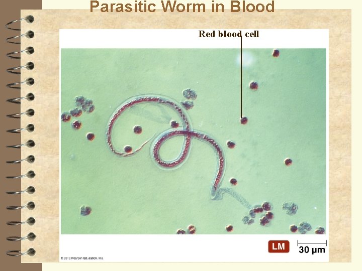 Parasitic Worm in Blood Red blood cell 