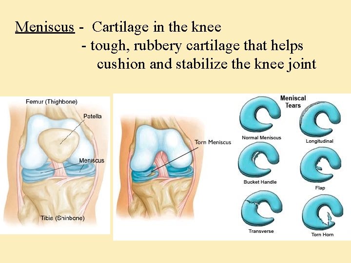 Meniscus - Cartilage in the knee - tough, rubbery cartilage that helps cushion and