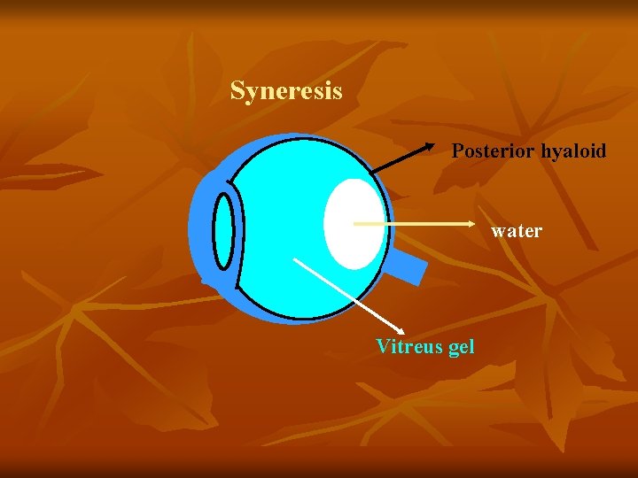 Syneresis Posterior hyaloid water Vitreus gel 