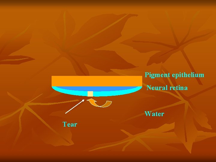 Pigment epithelium Neural retina Water Tear 