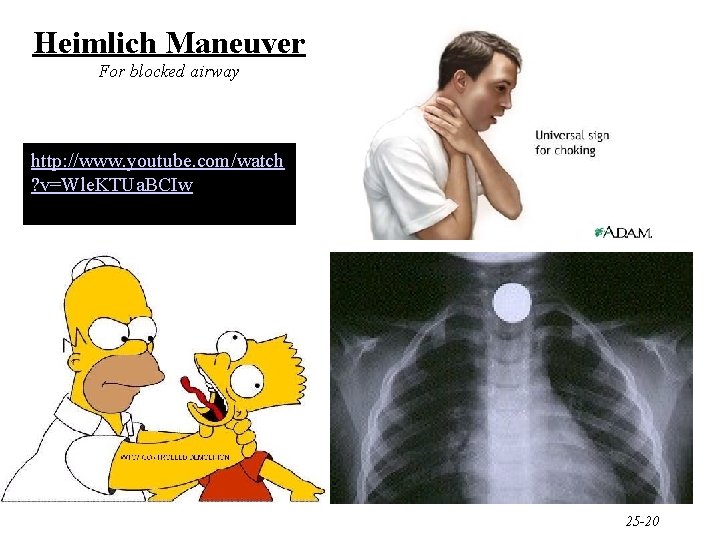 Heimlich Maneuver For blocked airway http: //www. youtube. com/watch ? v=Wle. KTUa. BCIw 25