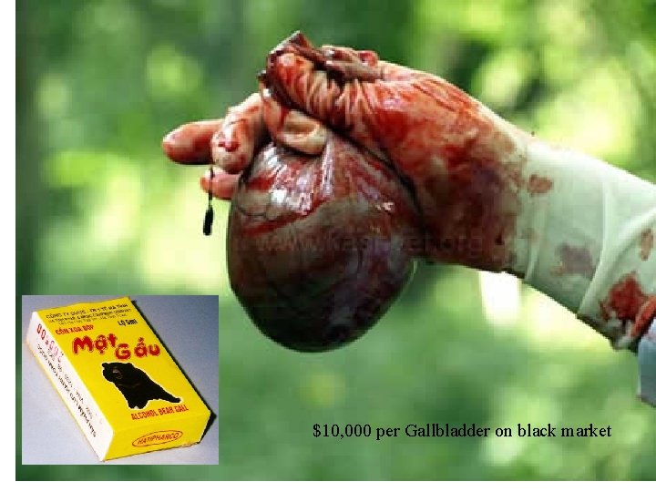 $10, 000 per Gallbladder on black market 25 -38 