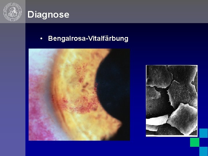 Diagnose • Bengalrosa-Vitalfärbung 