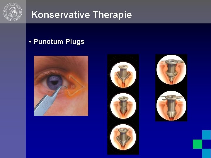Konservative Therapie • Punctum Plugs 