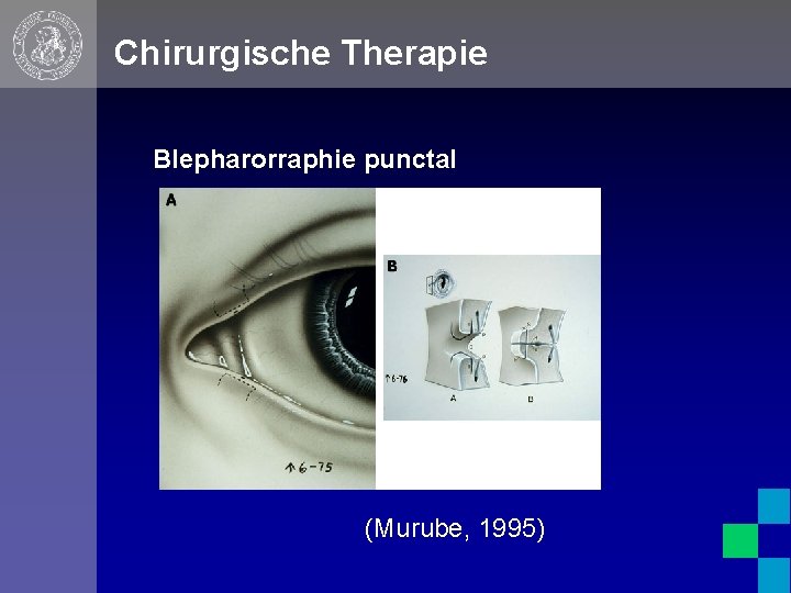 Chirurgische Therapie Blepharorraphie punctal (Murube, 1995) 