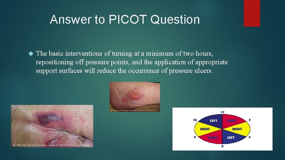 Answer to PICOT Question The basic interventions of turning at a minimum of two