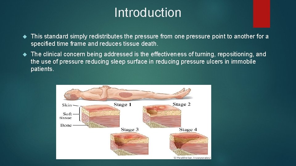Introduction This standard simply redistributes the pressure from one pressure point to another for