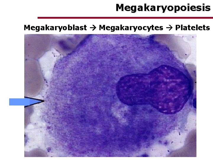 Megakaryopoiesis Megakaryoblast Megakaryocytes Platelets 