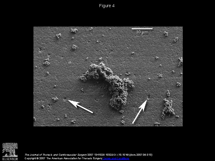 Figure 4 The Journal of Thoracic and Cardiovascular Surgery 2007 1341025 -1032 DOI: (10.