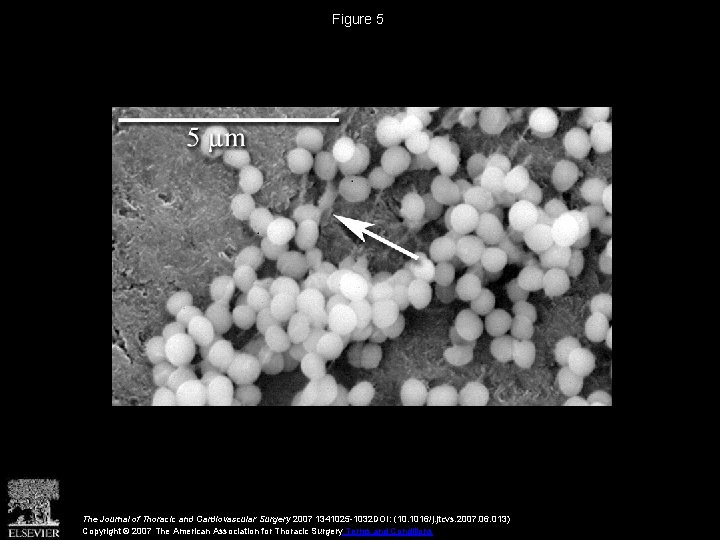 Figure 5 The Journal of Thoracic and Cardiovascular Surgery 2007 1341025 -1032 DOI: (10.