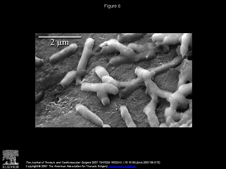 Figure 6 The Journal of Thoracic and Cardiovascular Surgery 2007 1341025 -1032 DOI: (10.